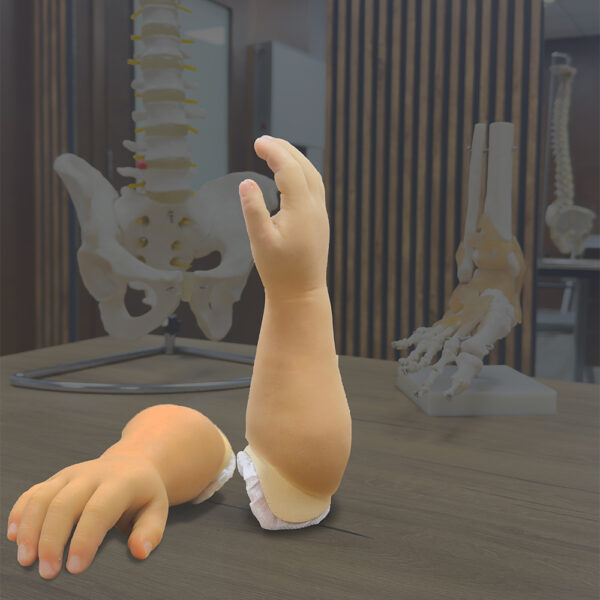 Below Elbow
