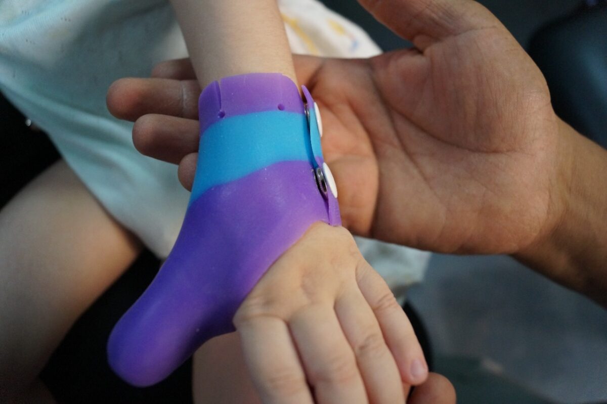 Silicon Thumb Brace – Center Singer is a medical center specialized in ...