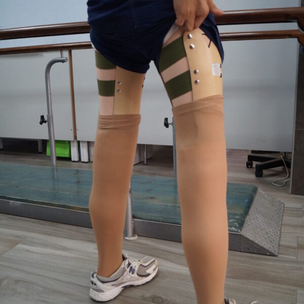 Knee disarticulation