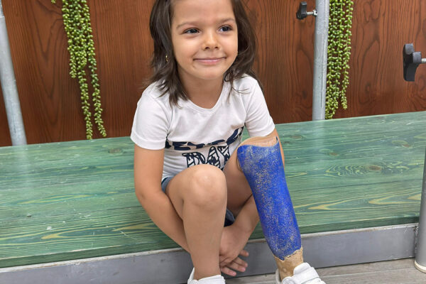 Below-Knee-Mariam-Hareb