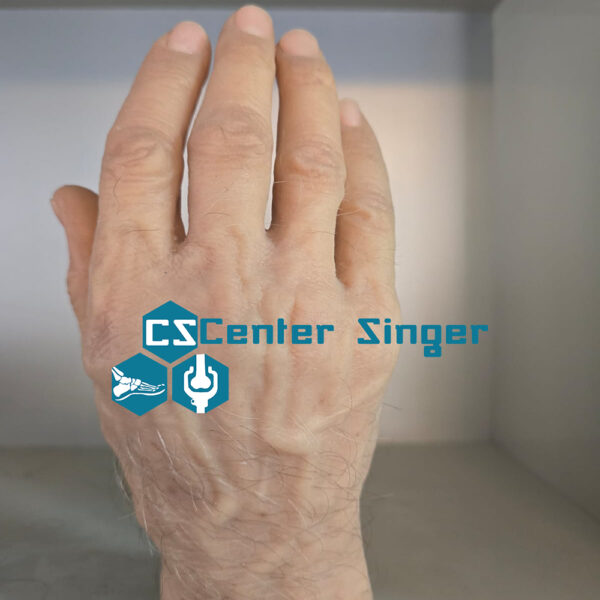اليدان